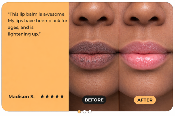 Turmeric Lemon Lip Restore