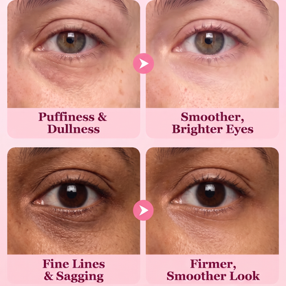 CollagenGlow Multi-peptide Eye Gel Patches