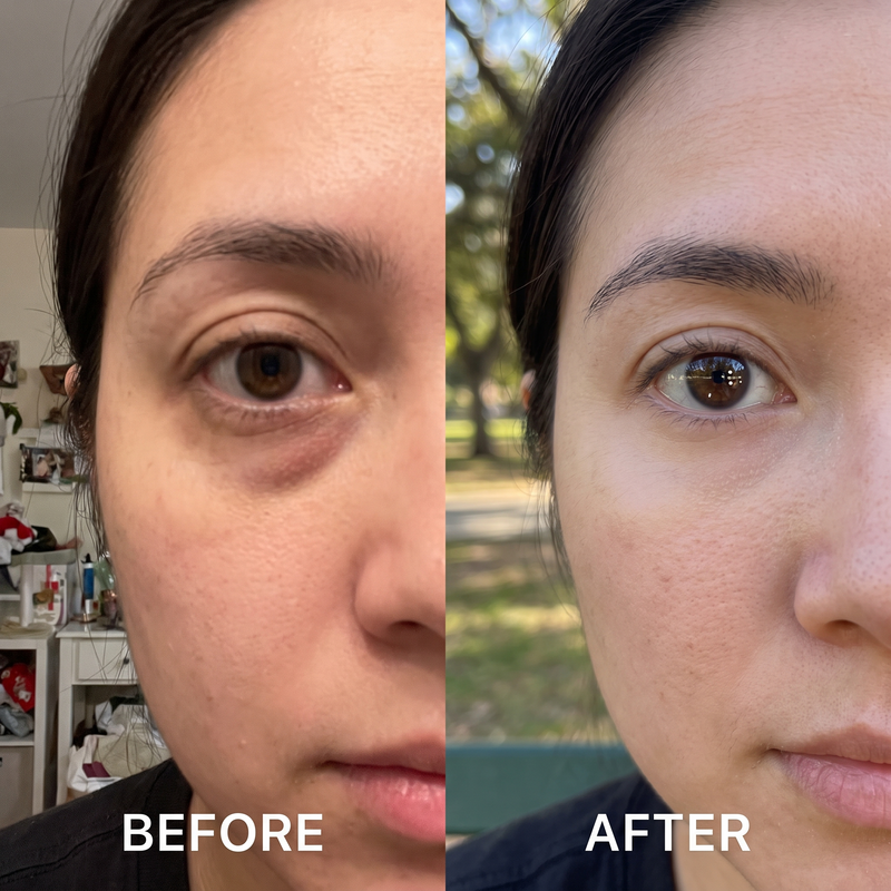 Brighter, Fresher-Looking Eyes